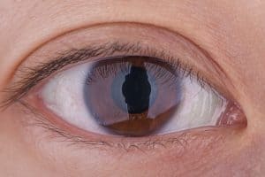 Il Health 37 דמעת מוגברת הפתרונות המתקדמים של דר שי קרן